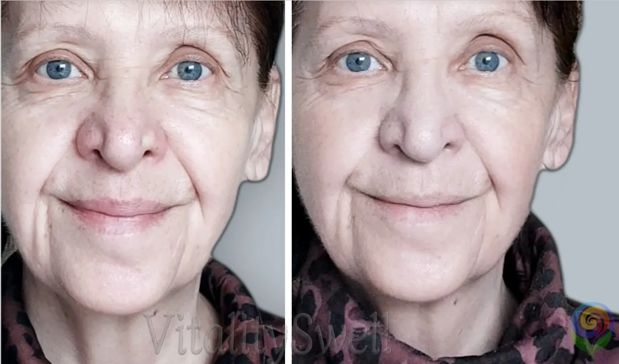 keskendus naerune 12 months of focus method restored the face – 2